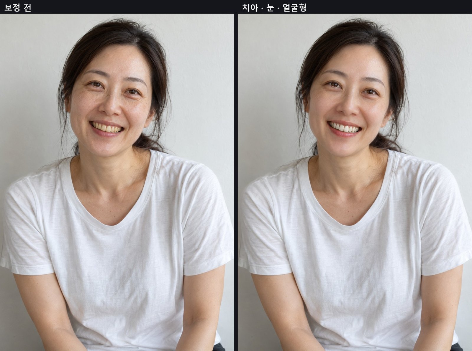 치아 미백 · 맑은 눈 · 갸름한 얼굴